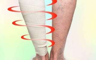 Treating Pain with Compression Therapy in Lakeland, Florida