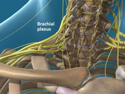 Interscalene Block Pain Treatment in Lakeland, Florida