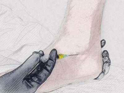 Ankle injection for pain treatment at Novus Spine & Pain Center