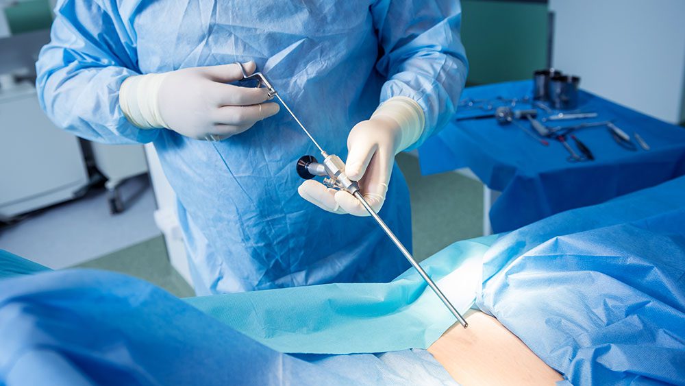 Minimally invasive endoscopic discectomy surgery for a herniated disc in Lakeland, Florida