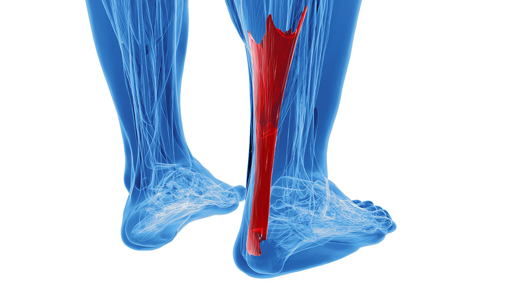 Medical illustration of the Achilles tendon and lower leg muscles