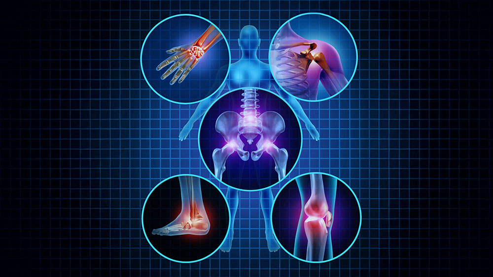 3D medical illustration of six painful joints